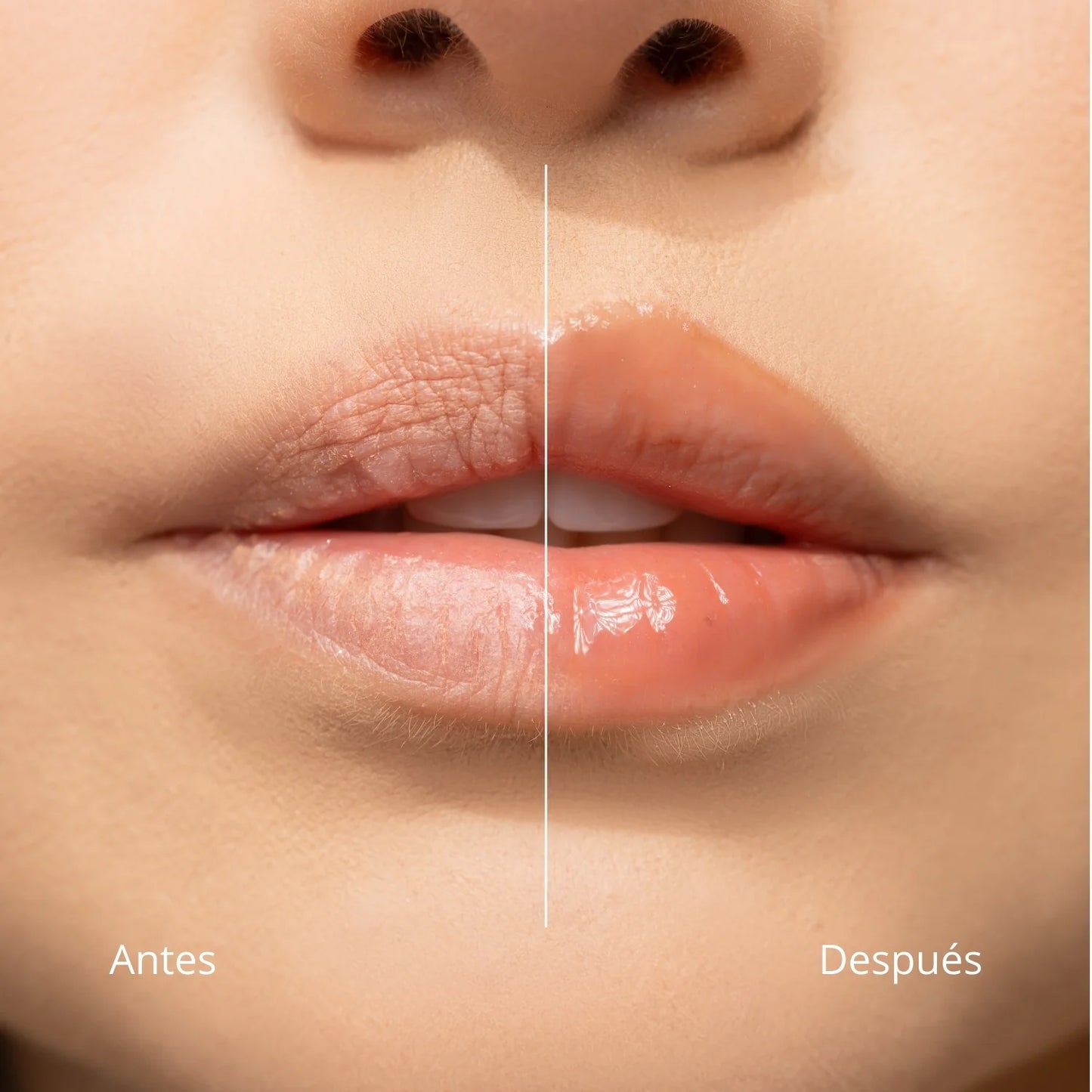 Lip Balm Hidratante Ani-K